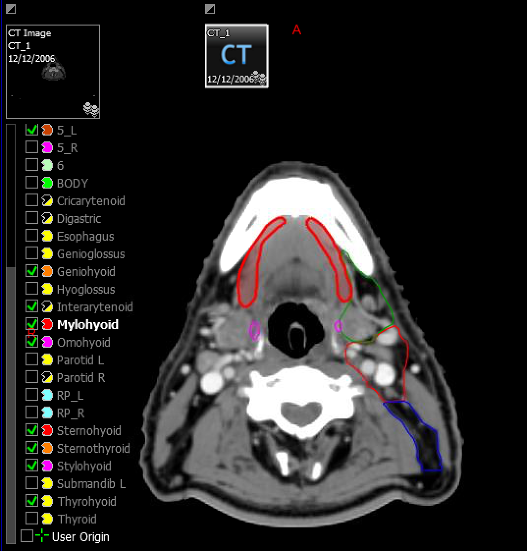 head neck scan image