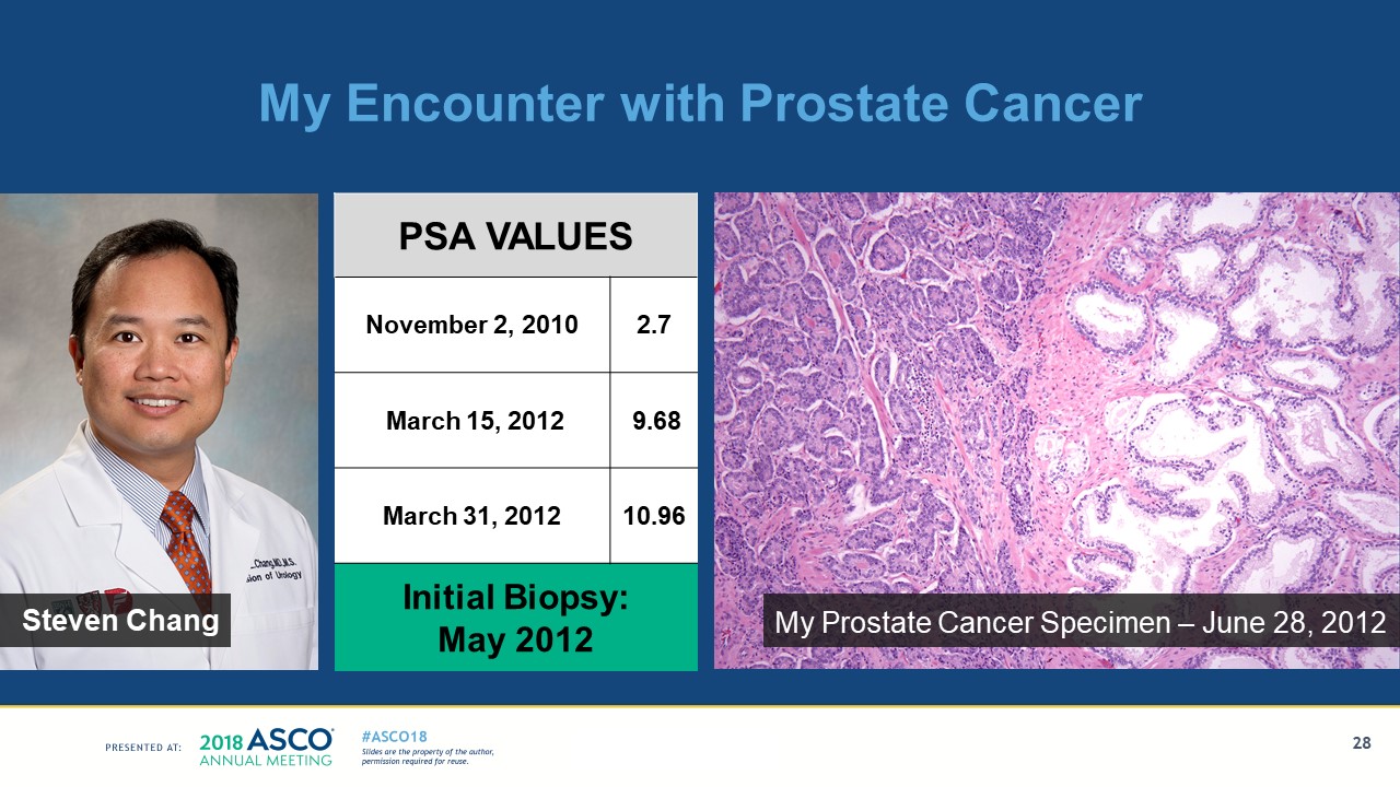 Johnson presentation - slide 28 prostate cancer 